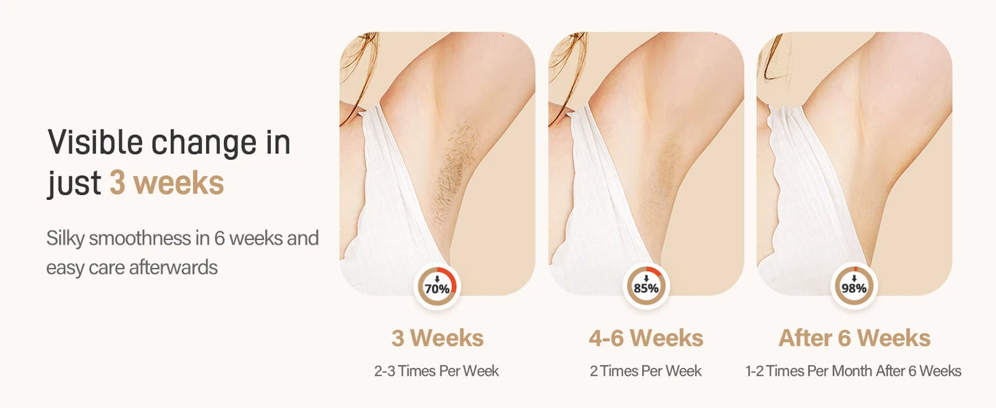 JOOYEECertification IPL Laser Hair Removal Device 3in1 For Home Use